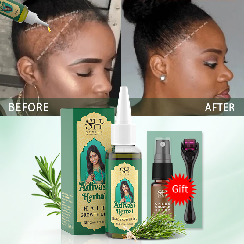Olio Ayurvedico per la Crescit - Hair Care Fragrance Essential Oil recensione e prezzo