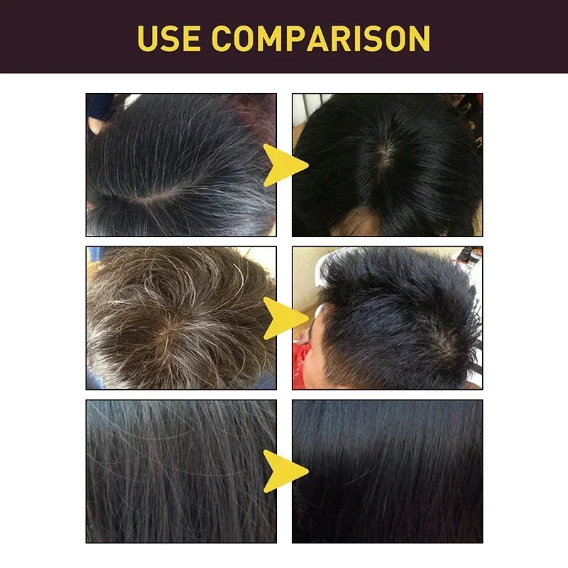 Shampoo per tintura per capell - Hair Care Loreal recensione e prezzo