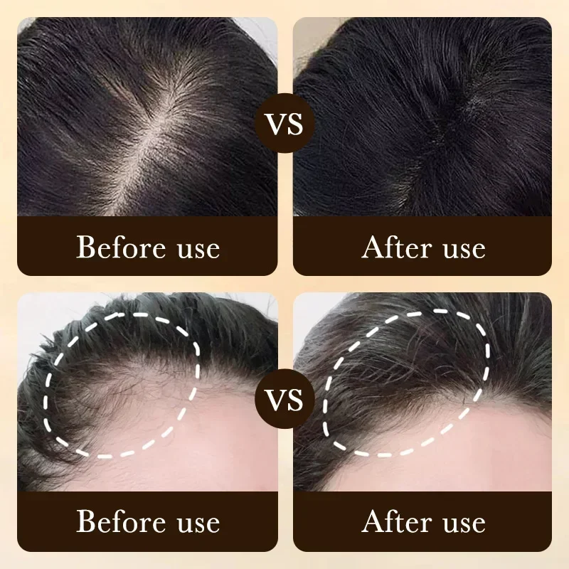 Olio per Crescita Rapida dei C - Hair Care Fragrance Essential Oil recensione e prezzo