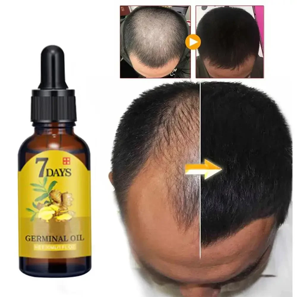 Crescita dei capelli Zenzero C - Hair Care Fragrance Essential Oil recensione e prezzo